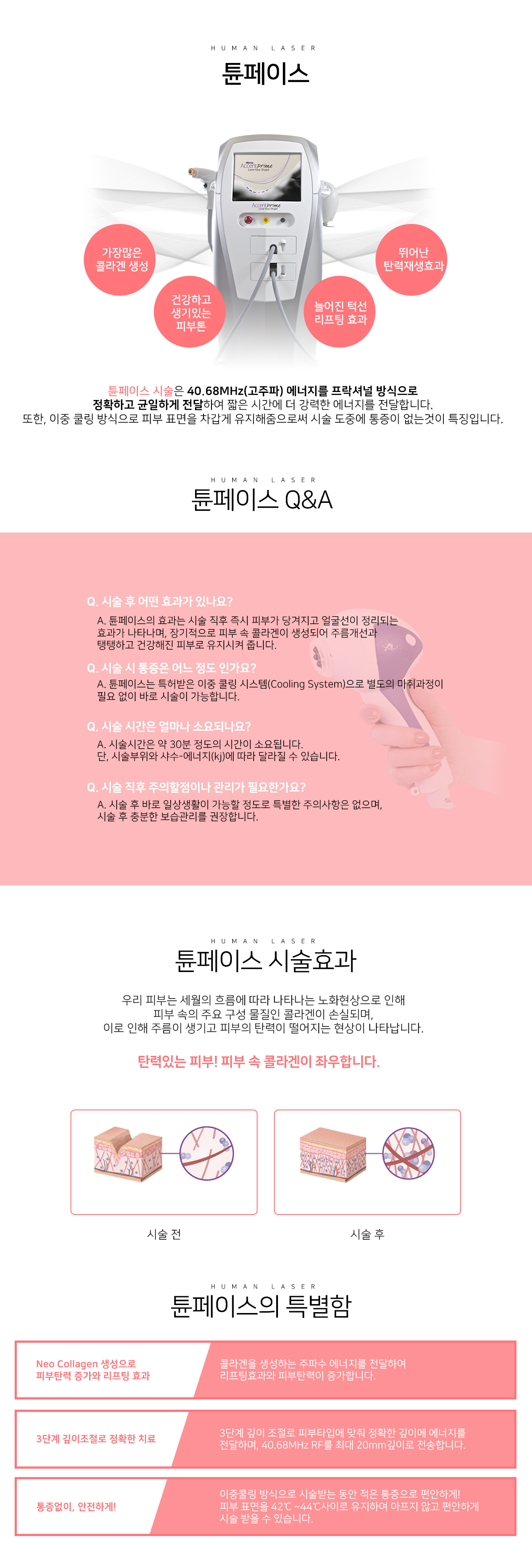 탄력/리프팅