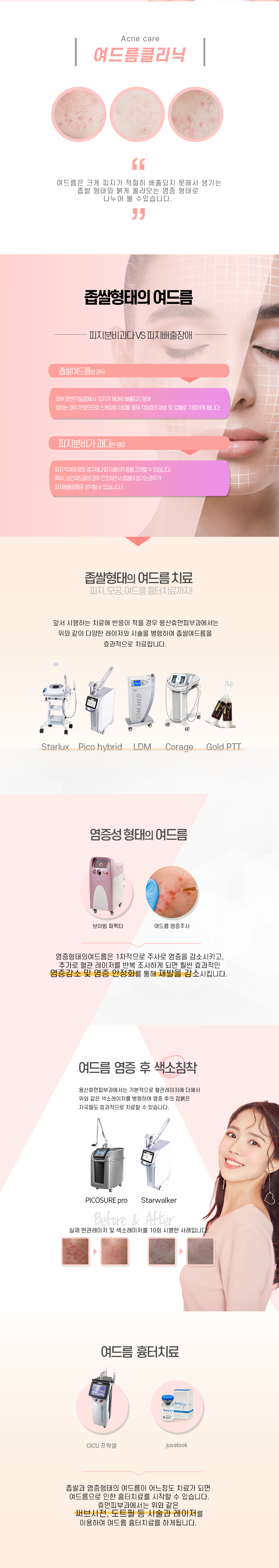 여드름