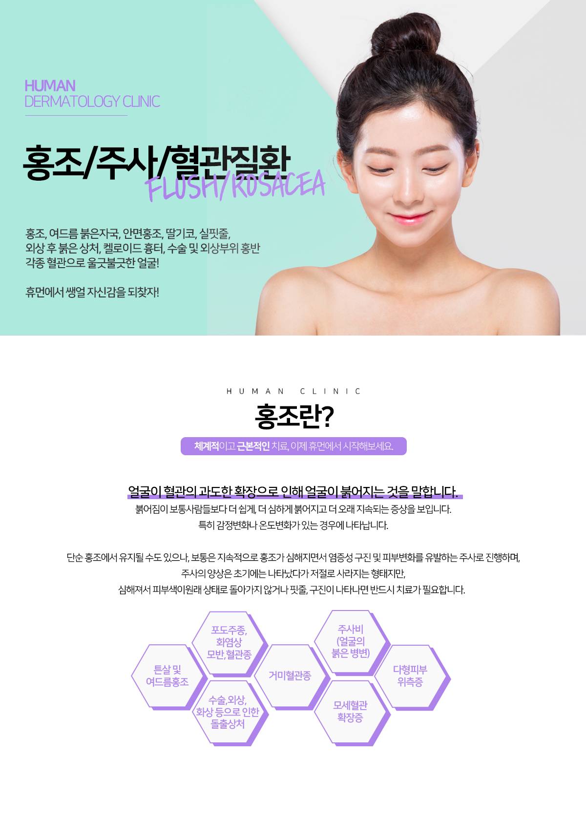 홍조/혈관질환