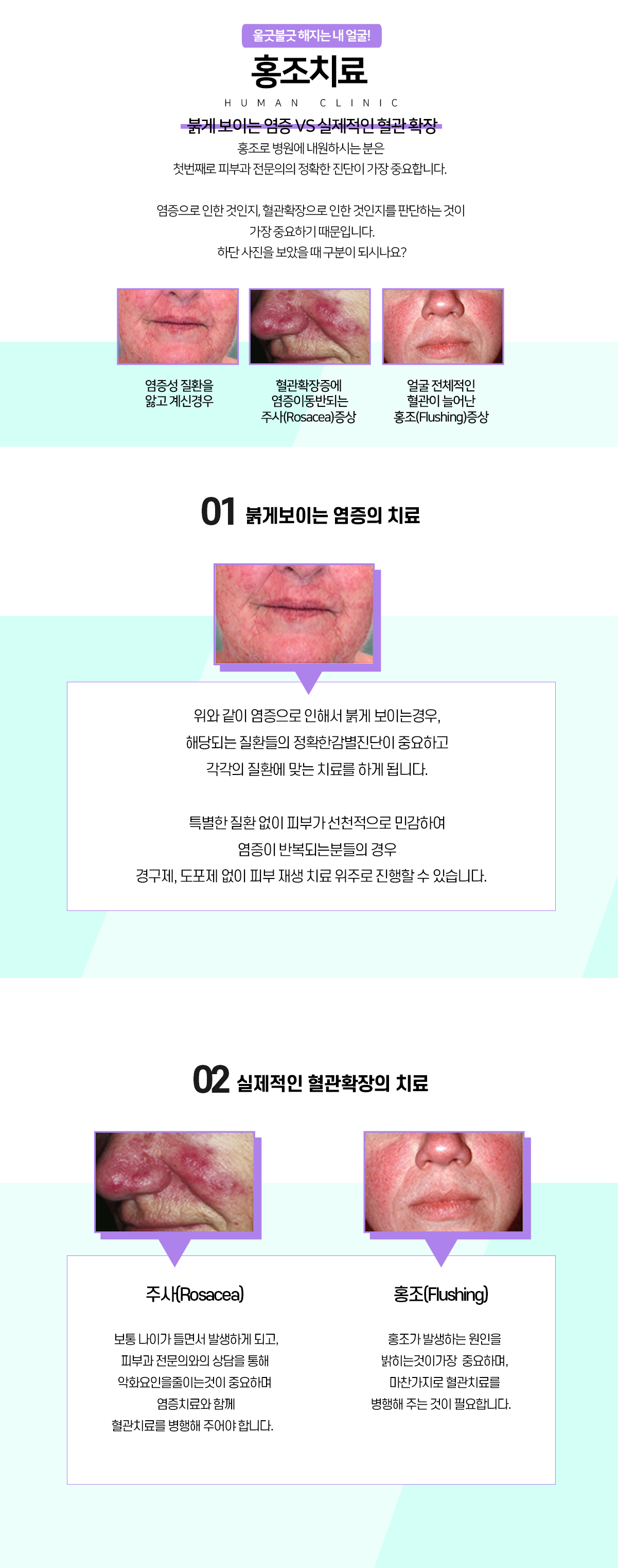 홍조/혈관질환