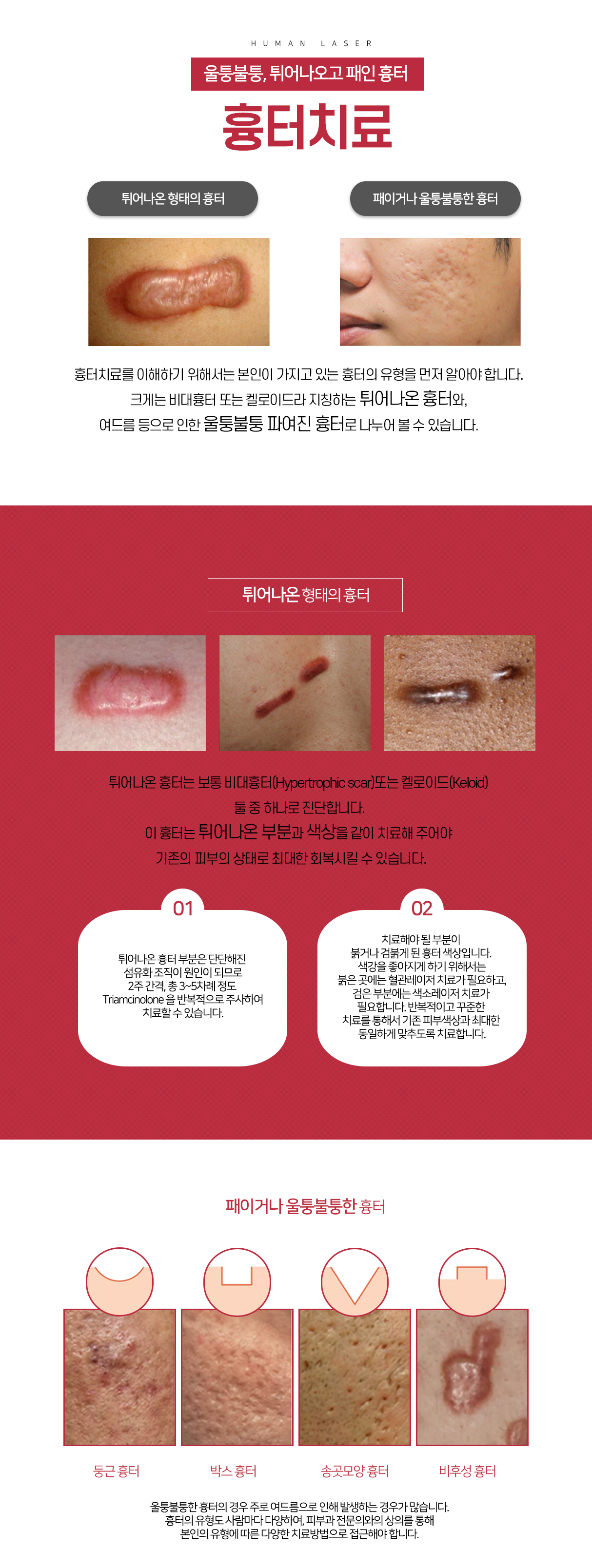 흉터/모공